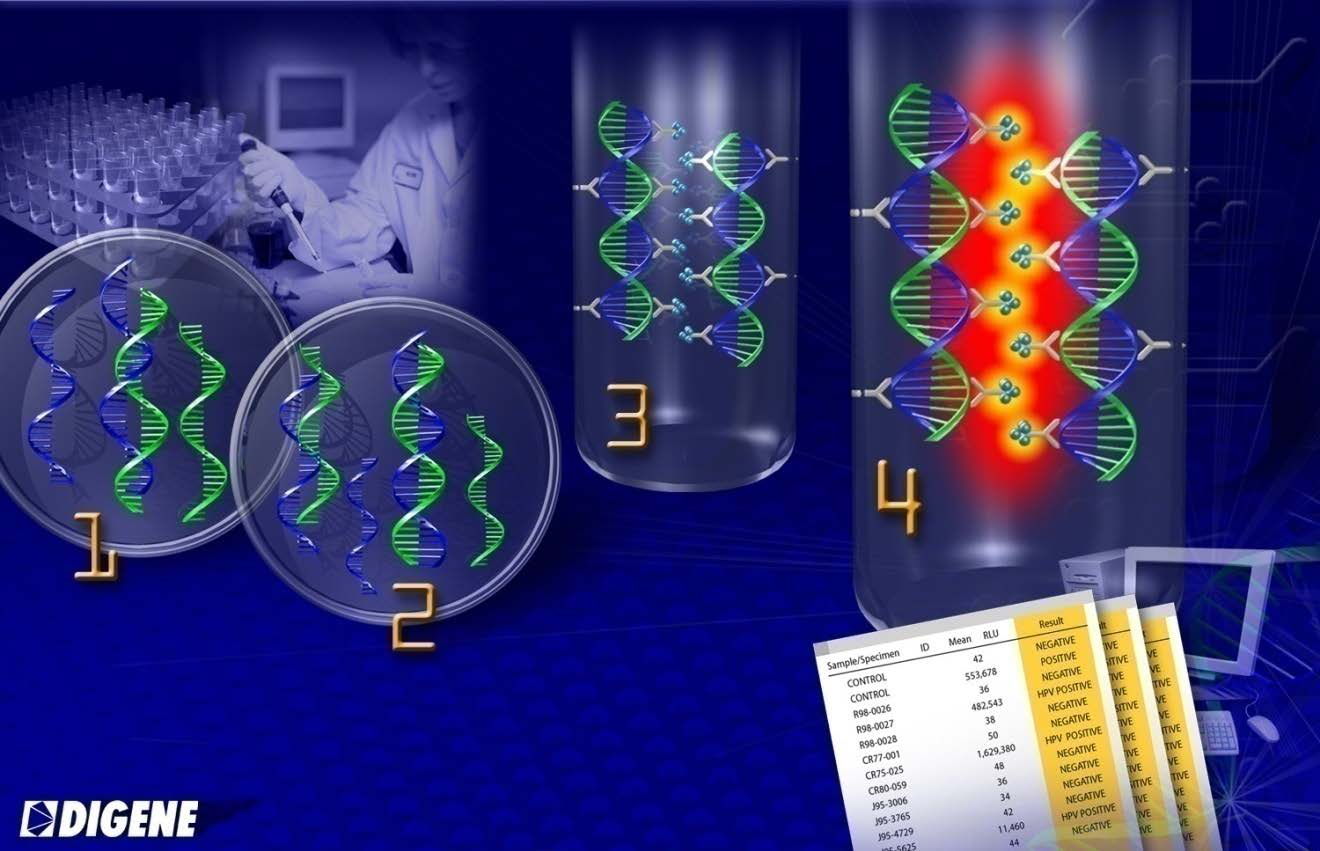 Hybrid Capture II (με έγκριση FDA) Ημιποσοτική ανίχνευση (No IC!) 1. Αποδιάταξη DNA 2.