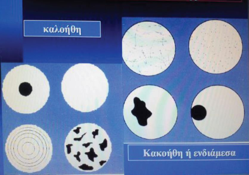 Πρότυπα