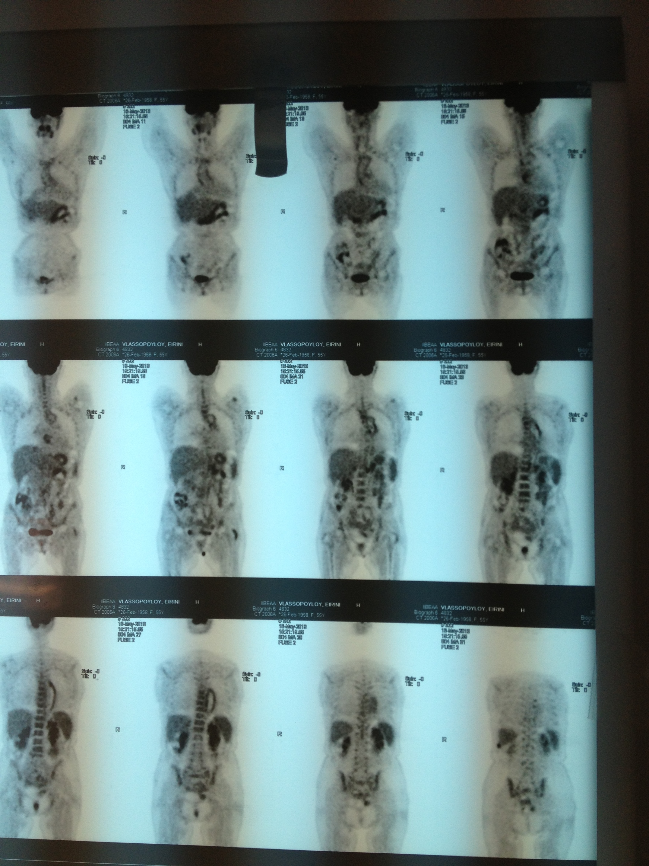 PET scan, Ινστιτούτο