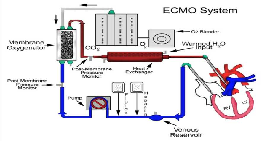 ECMO