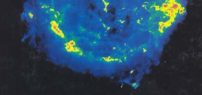 Τέλος, στο σηµείο αυτό, πρέπει να αναφερθεί η έκρηξη υπερκαινοφανή τύπου II που παρατηρήθηκε το Φεβρουάριο του 987 στο Μεγάλο Νέφος του Μαγγελάνου (SN987A). Το Σχήµα 6.