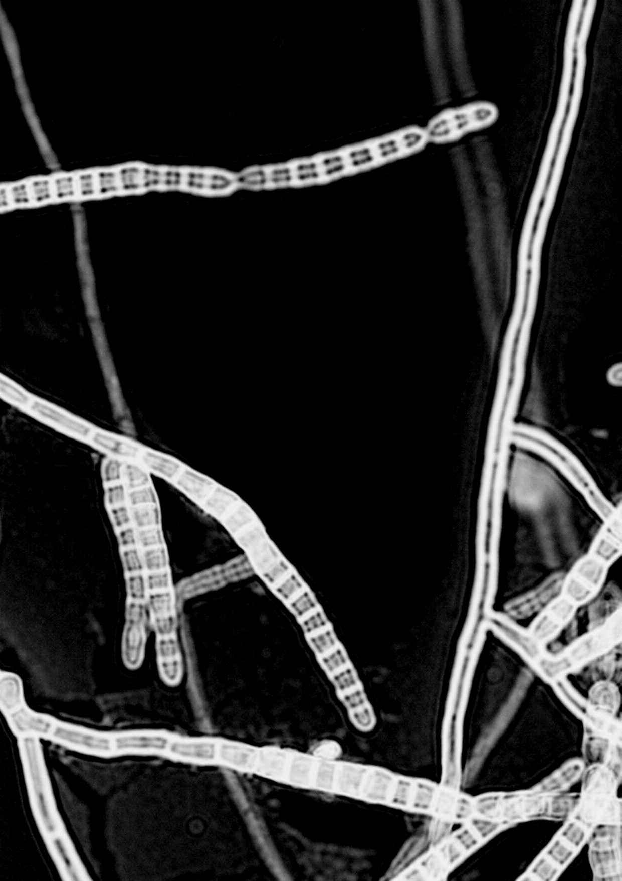 ÊÜèáñóç êñåáôéíßíçò Clearance creatinine urine ÊÜèáñóçò êñåáôéíßíçò Áíáéìßá Åãêáýìáôá Êýçóç Äßáéôá õøçëþ óå ðñùôåàíåò ÕðïëïãéóôéêÞ 500 ìl ïñüò Þ ðëüóìá (EDTA) êáé ïýñá 24þñïõ Ï áóèåíþò êáôü ôç