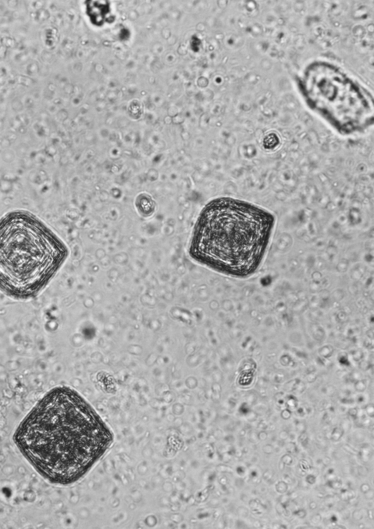 ÊÜëéï, Ê+ ïñïý Potassium ÊÜëéï ïýñùí 24h Potassium urine 24h Óðåêôïöùôüìåôñï 500 ìl ïñüò /ü é áéìïëõìýíïò Þ ðëüóìá (çðáñßíç).