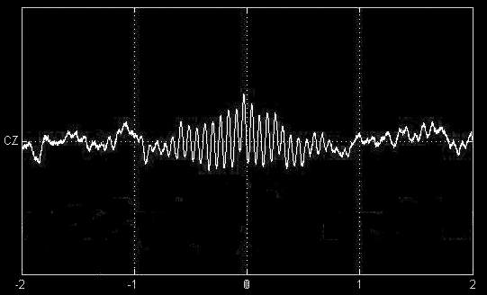 Άτρακτος (11-15 Ηz) 1 second