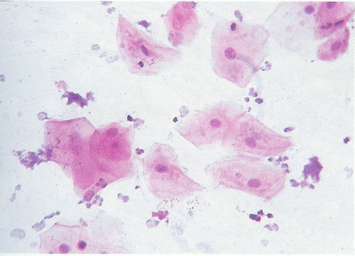 ΑΣΚΗΣΗ 2 η : ΜΕΛΕΤΗ ΖΩΙΚΩΝ ΚΥΤΤΑΡΩΝ Σκοποί: Α. Η εξοικείωση με τη χρήση του μικροσκοπίου Β. Η μικροσκοπική παρατήρηση ζωικών κυττάρων (ανθρώπου) Β.
