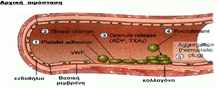 Α.2. Αρχική αιµόσταση Περιλαµβάνει τη σύσπαση του αγγείου στο σηµείο της βλάβης και την συγκόλληση των αιµοπεταλίων.