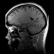 Magnetic Resonance Imaging (MRI) Θεμελιώδης τεχνολογία ιατρικής απεικονιστικής χρησιμοποιεί ισχυρούς υπεραγώγιμους μαγνήτες και το φαινόμενο πυρηνικού μαγνητικού συντονισμού (NMR) για την δημιουργία