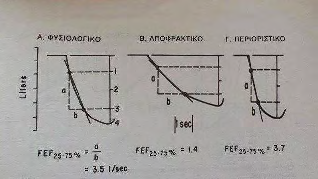 Η Εικόνα 3.7.1Β απεικονίζει την καταγραφή ενός ασθενή που πάσχει από χρόνια αποφρακτική πνευμονοπάθεια. Ο τρόπος εκπνοής του αέρα είναι βραδύτερος, έτσι μόνο 1.