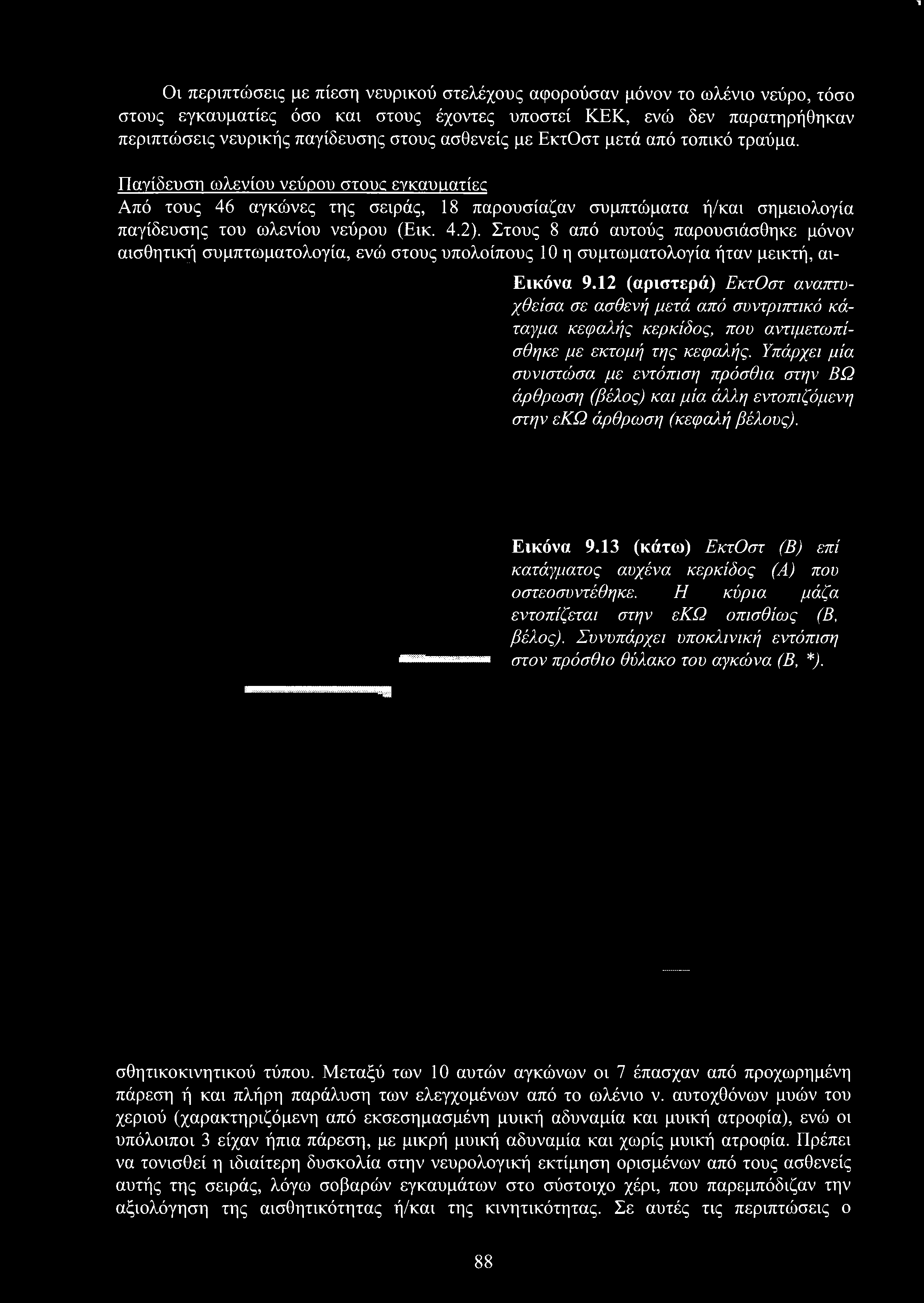 T Ον περιπτώσεις με πίεση νευρικού στελέχους αφορούσαν μόνον το ωλένιο νεύρο, τόσο στους εγκαυματίες όσο και στους έχοντες υποστεί ΚΕΚ, ενώ δεν παρατηρήθηκαν περιπτώσεις νευρικής παγίδευσης στους