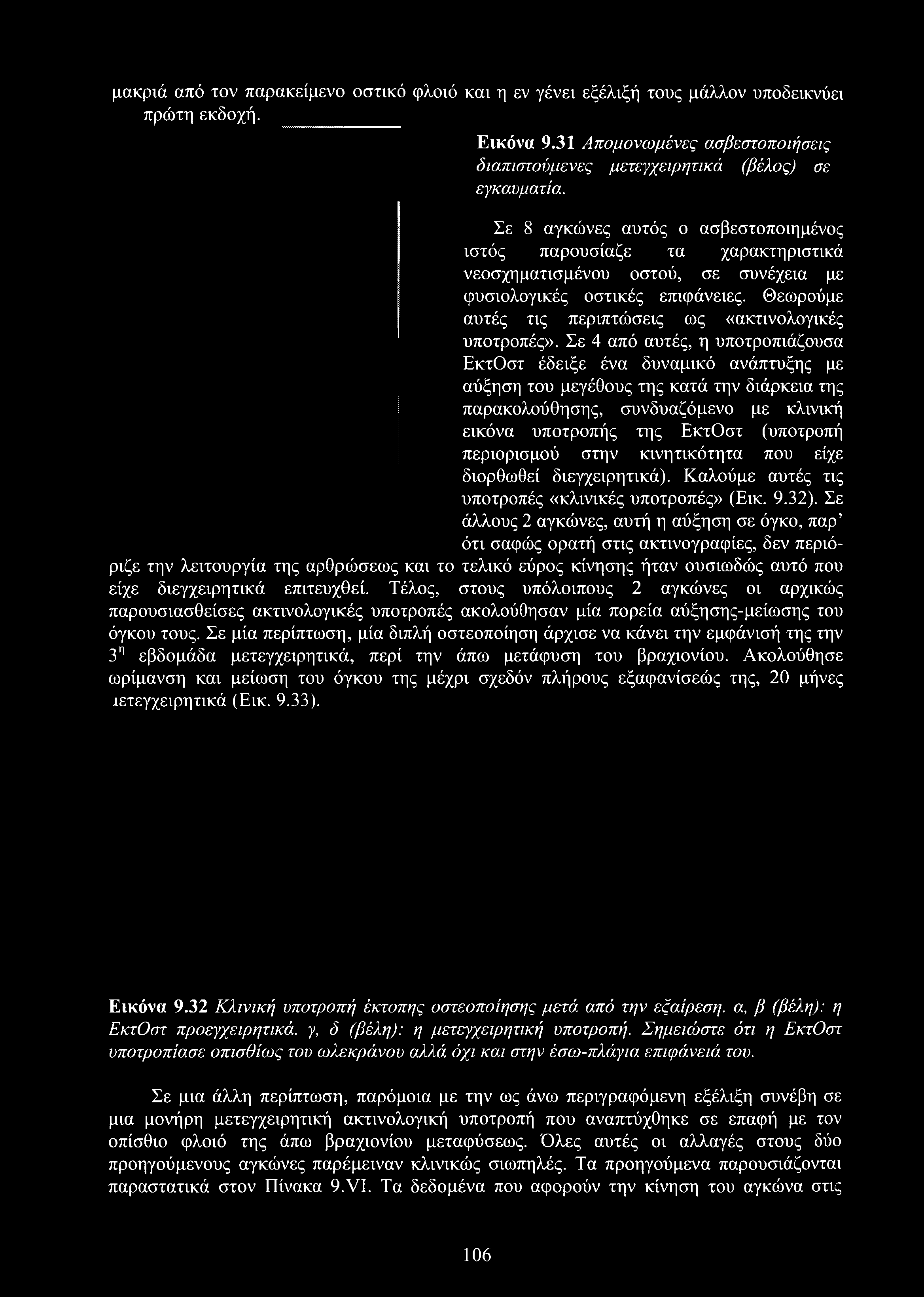 μακριά από τον παρακείμενο οστικό φλοιό και η εν γένει εξέλιξή τους μάλλον υποδεικνύει πρώτη εκδοχή. Εικόνα 9.31 Απομονωμένες ασβεστοποιήσεις διαπιστούμενες μετεγχειρητικά (βέλος) σε εγκαυματία.