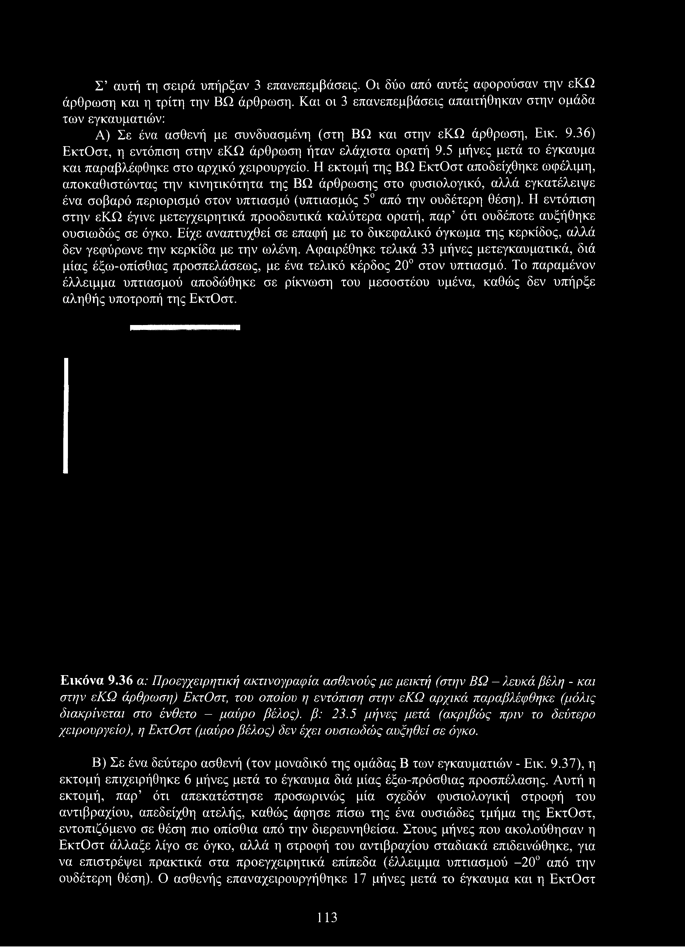 Σ αυτή τη σειρά υπήρξαν 3 επανεπεμβάσεις. Οι δύο από αυτές αφορούσαν την εκω άρθρωση και η τρίτη την ΒΩ άρθρωση.