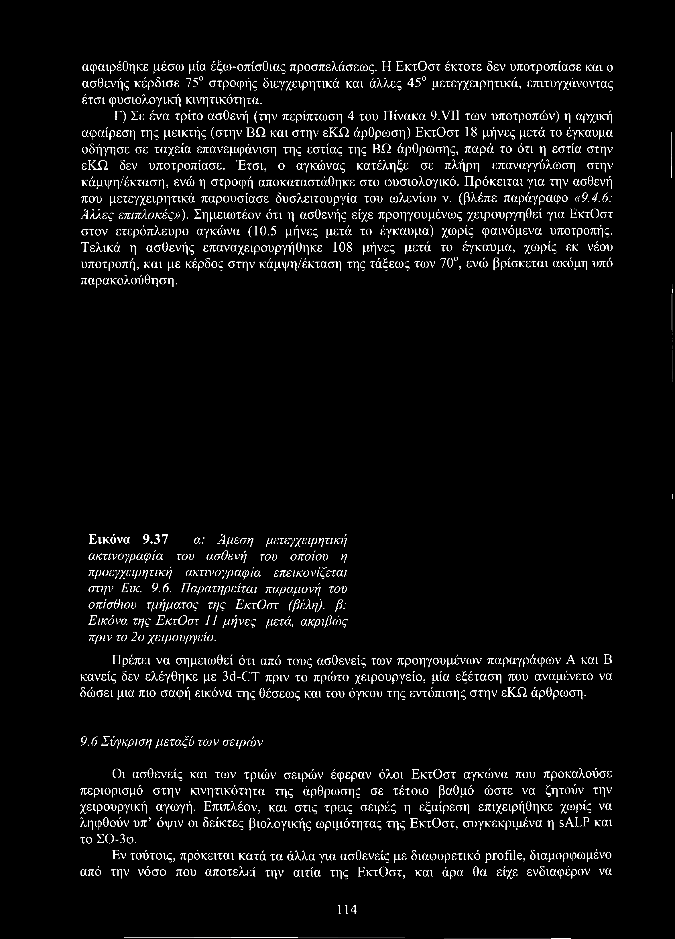 αφαιρέθηκε μέσω μία έξω-οπίσθιας προσπελάσεως. Η ΕκτΟστ έκτοτε δεν υποτροπίασε και ο ασθενής κέρδισε 75 στροφής διεγχειρητικά και άλλες 45 μετεγχειρητικά, επιτυγχάνοντας έτσι φυσιολογική κινητικότητα.