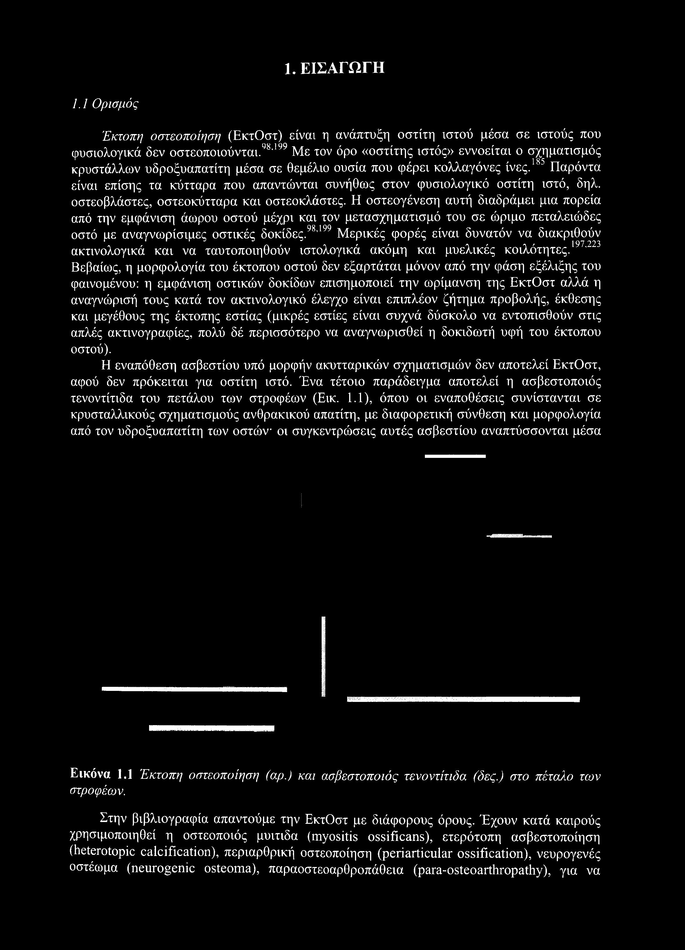 1. ΕΙΣΑΓΩΓΗ 1.1 Ορισμός Έκτοπη οστεοποίηση (ΕκτΟστ) είναι η ανάπτυξη οστίτη ιστού μέσα σε ιστούς που φυσιολογικά δεν οστεοποιούνται.