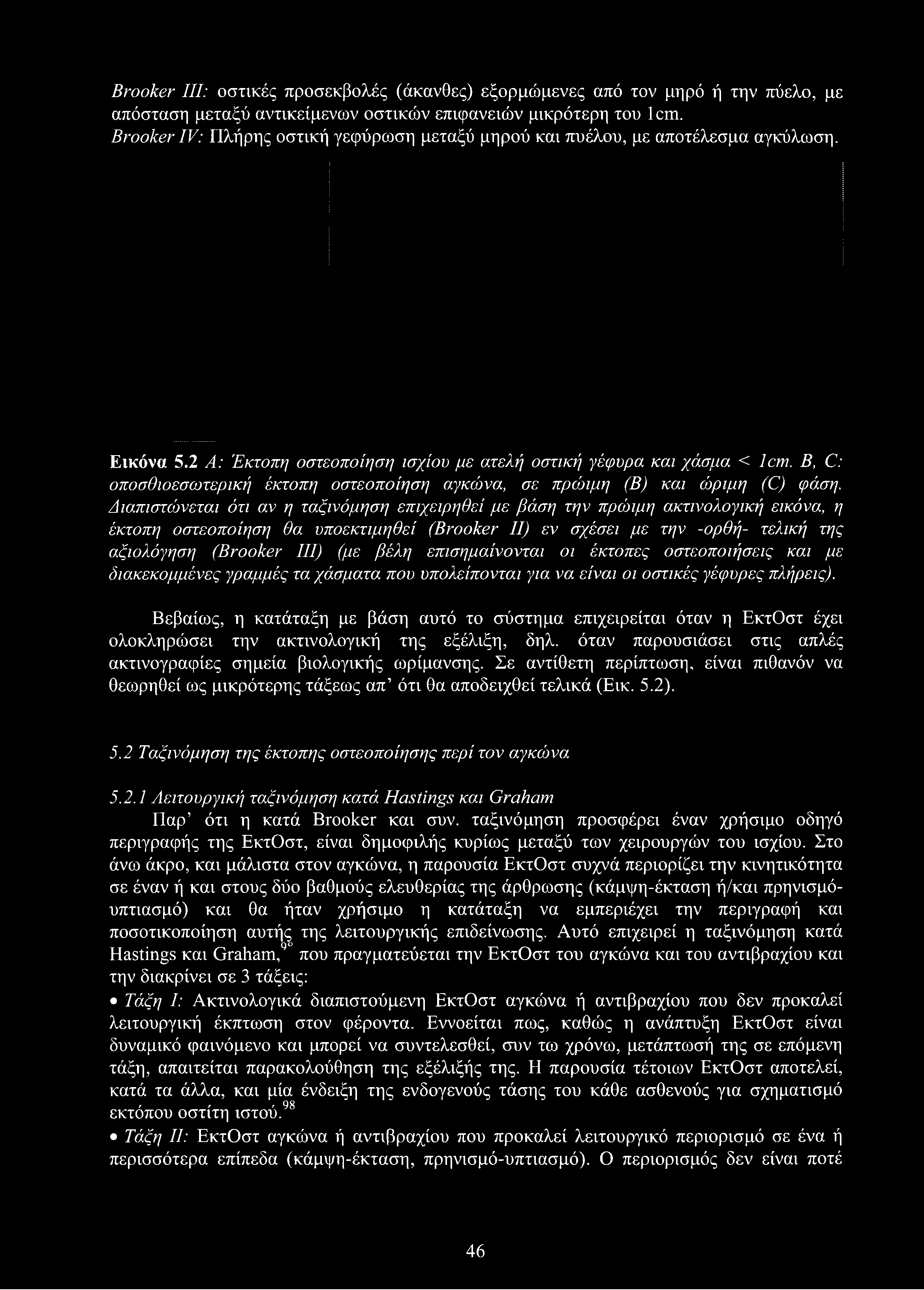 Brooker III: οστικές προσεκβολές (άκανθες) εξορμώμενες από τον μηρό ή την πύελο, με απόσταση μεταξύ αντικείμενων οστικών επιφανειών μικρότερη του 1 cm.