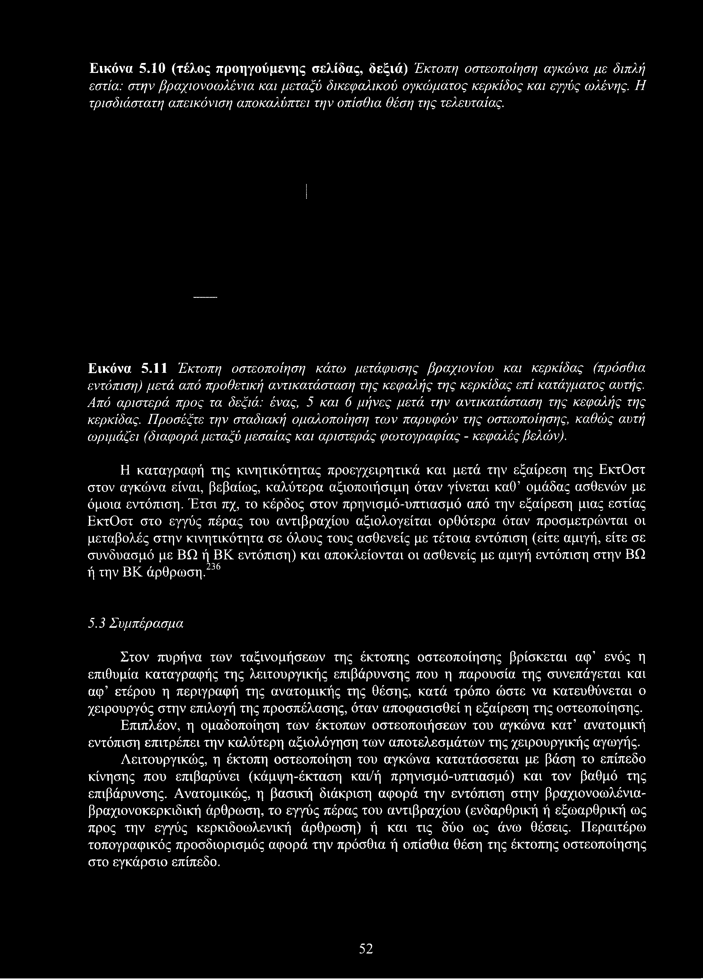 Εικόνα 5.10 (τέλος προηγούμενης σελίδας, δεξιά) Έκτοπη οστεοποίηση αγκώνα με διπλή εστία: στην βραχιονοωλένια και μεταξύ δικεψαλικού ογκώματος κερκίδος και εγγύς ωλένης.