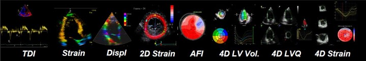 NEWER IMAGING MODALITIES # Tissue Doppler imaging 1994 # Doppler strain strain rate 1999 #