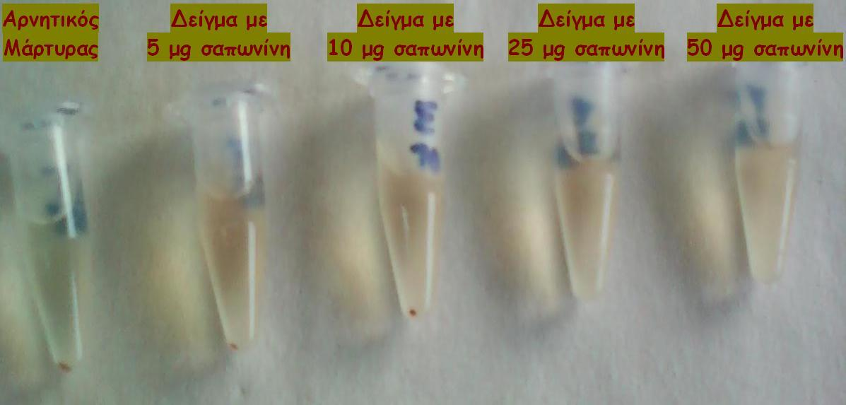 ε ιία ζεζνά απυ πέκηε ζςθδκάηζα eppendorfs πνμζηέεδηε δζάθοια αζςνήιαημξ ενοενχκ αζιμζθαζνίςκ ιε ηεθζηή αναίςζδ 1:400 απυ ημ μθζηυ αίια ηαζ πμζυηδηα θεοηήξ ζαπςκίκδξ ηυζδ χζηε δ ηεθζηή ηδξ