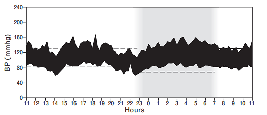 Νυκτερινή πτώση ΑΠ (Dipping) Υπέρταση κατά την ημέρα με διατήρηση της νυκτερινής πτώσης BP constantly elevated during daytime (awake) time, with low night-time (asleep) BP. Clinic BP at 146/86 mmhg.