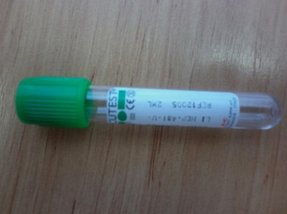 Odber krvi na fagocytárnu aktivitu. Odberový materiál: Lithium heparin/20 zelená LI HEP 2ml Odber vzorky: 1.