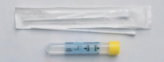 3.2. Odber vzorky na DNA stanovenie Výter z cervixu na stanovenie mikrobiálnej DNA (PCR) (DNA Chlamydia trachomatis, DNA Neisseria gonorrhoeae, DNA Mycoplasma genitalium, DNA Mycoplasma hominis, DNA
