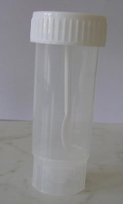 laboratória, kde sa zisťuje prítomnosť toxínu A produkovaného kmeňom C. difficile.