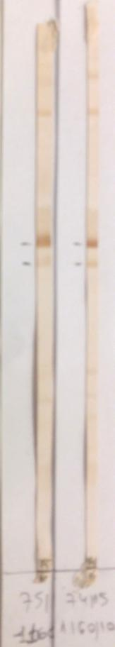 Νεφρός Αυτοαντιγόνα στόχοι: anti-cyp2d6 (anti-ugt 1.