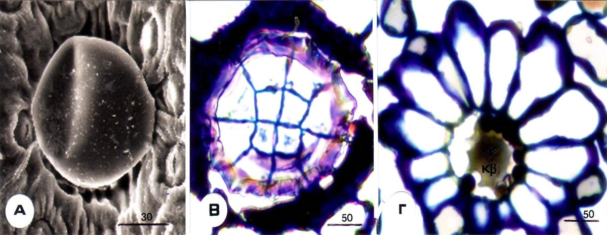 59 Εικ. 9. Thymus sibthorpii. Α. Μαθξνθέθαιε αδεληθή ηξίρα ζην ειεθηξνληθό κηθξνζθόπην ζάξσζεο. Β. Δθαπηνκεληθή ηνκή ηεο θεθαιήο, ε νπνία απνηειείηαη από 12 θύηηαξα. Γ.