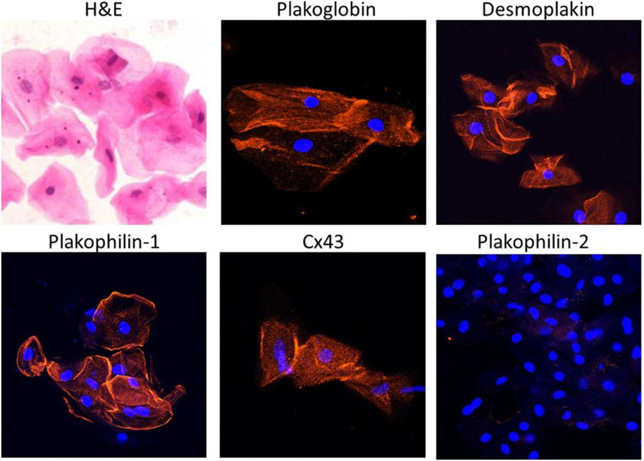 Representative images of normal buccal mucosa smears. Angeliki Asimaki et al.