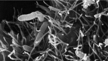 Βακτήρια που Παρουσιάζουν Ενδιαφέρον στη Μικροβιολογία Τροφίμων 3/4 Gram (-) προαιρετικά αναερόβια βακτήρια. Escherichi (E. coli O157:H7) Enterobacter spp. (E. aerogenes) Salmonella spp. (S.