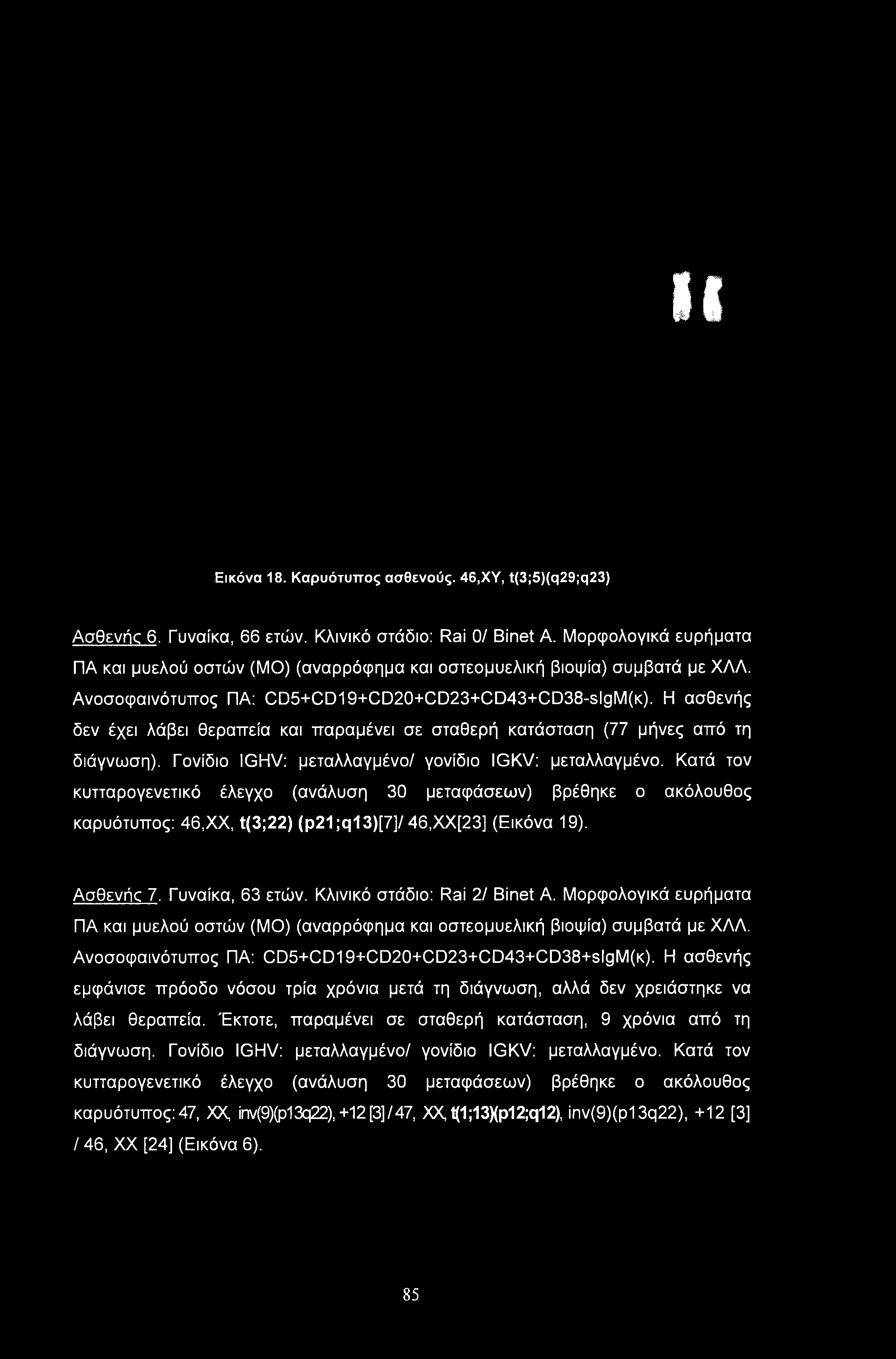 HI Εικόνα 18. Καρυότυπος ασθενούς. 46,ΧΥ, t(3;5)(q29;q23) Ασθενής 6. Γυναίκα, 66 ετών. Κλινικό στάδιο: Rai 0/ Binet Α.