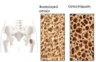 ΚΕΦΑΛΑΙΟ 1 ΘΕΡΑΠΕΥΤΙΚΗ ΧΡΗΣΗ ΤΗΣ ΤΙΜΠΟΛΟΝΗΣ 1.3 