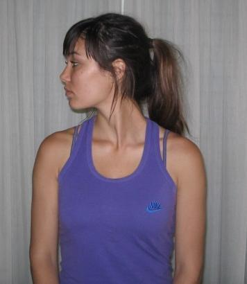Εικόνα 5.2.2.3(physio-aid.gr) Έκταση αυχένα. Ο ασθενής βρίσκεται στην όρθια στάση με την σπονδυλική του στήλη ευθεία. Οι ώμοι του είναι ελαφρώς πίσω.