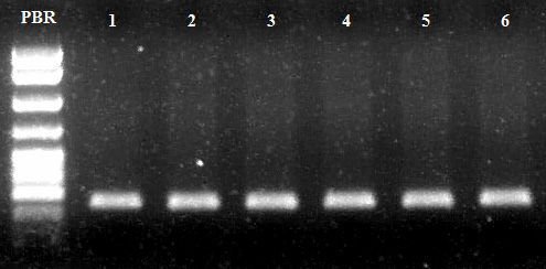 Πίνακας 12. Συνθήκες της αντίδρασης PCR για την ενίσχυση του γονιδίου αναφοράς Abl.