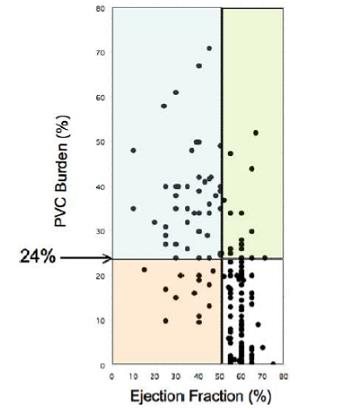 VPD CARDIOMYOPATHY 174 ασθενείς. 57/134 (33%) Μειωμένο κλάσμα εξώθησης (0,37±0,10) Μειωμένο EF: Αρρυθμιογόνο φορτίο 33%±10%. Φυσιολογικό EF: Αρρυθμιογόνο φορτίο 13%±12%.