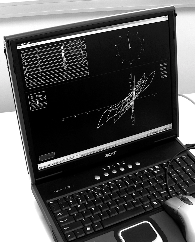 Για την καταγραφή της απόκρισης του φορέα χρησιµοποιήθηκαν 4 ανεξάρτητα κανάλια καταγραφής.