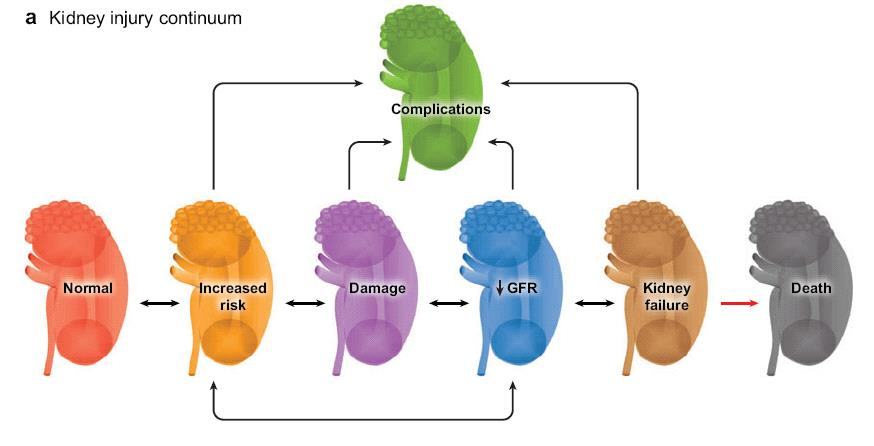 Conceptual Model of AKI