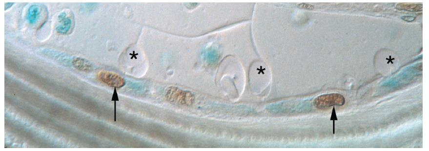 Aπόπτωση οστεοβλαστών σε μακροχρόνια λήψη κορτικοειδών Απόπτωση οστεοβλαστών σε μακροχρόνια λήψη κορτικοειδών, όπως φαίνεται με την τεχνική
