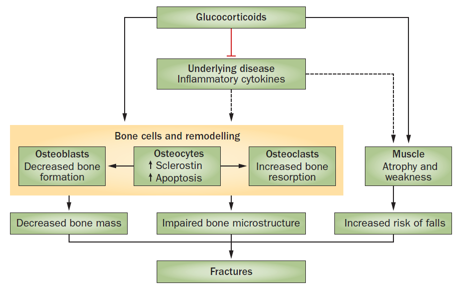 Παθογένεση της οστεοπόρωσης από μακροχρόνια χρήση