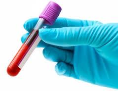 Εργαστηριακές Εξετάσεις Γενική Αίματος Αριθμός