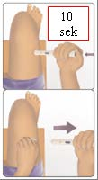 C. Používanie Avonex Pen 1 1 Očistite miesto podania injekcie. V prípade potreby kožu na zvolenom mieste vpichu potrite alkoholovým tampónom. Nechajte kožu vyschnúť.