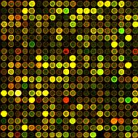 Uplatnenie PCR v medicínskej praxi Skoré rozpoznanie geneticky podmienených ochorení má význam nielen terapeutický, ale tiež ekonomický.