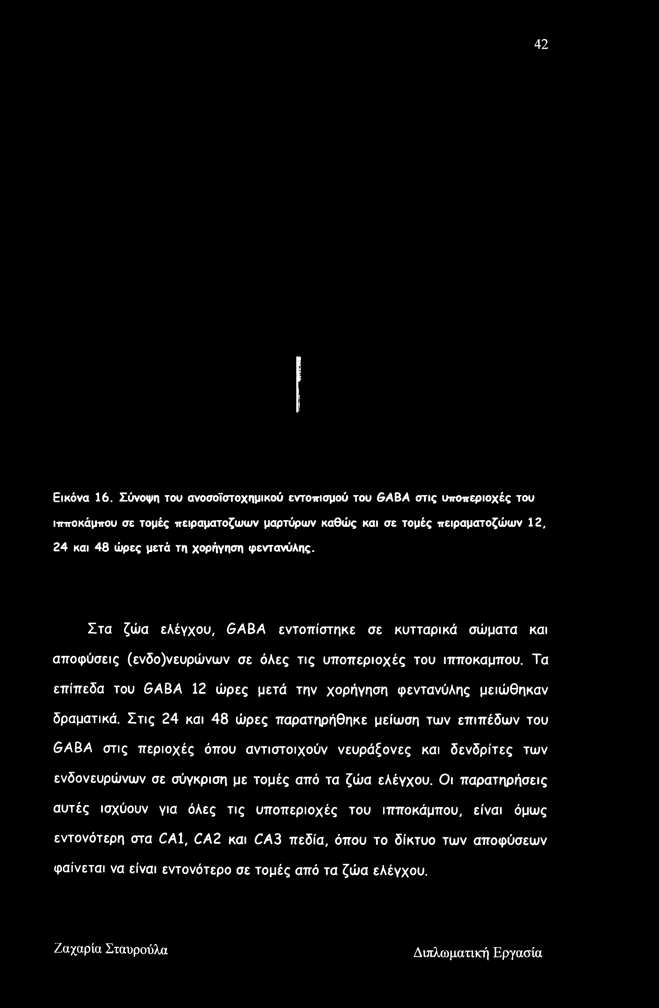 Τα επίπεδα του GABA 12 ώρες μετά την χορήγηση φεντανύλης μειώθηκαν δραματικά.