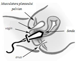 Introduceti 2 baterii alcaline AAA (LR3) si asigurati-va ca le-ati pozitionat corect, cu polaritatile "+" si "-" conform indicatiilor aratate la locul de asezare a acestora, apoi puneti capacul. 4.