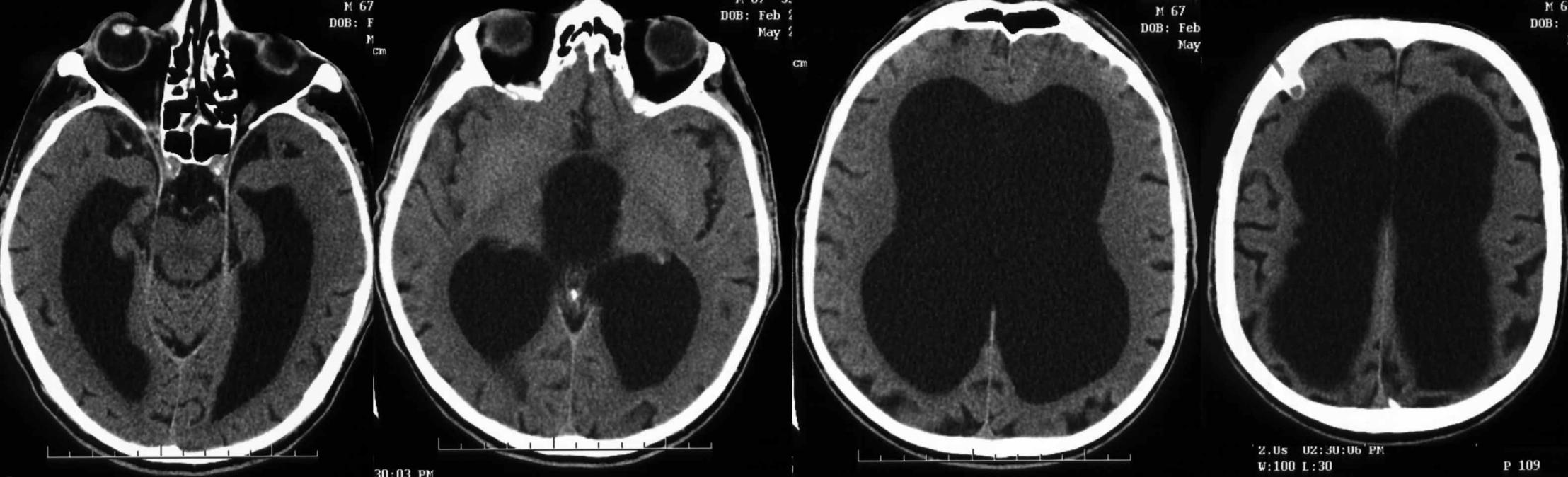 MRI: