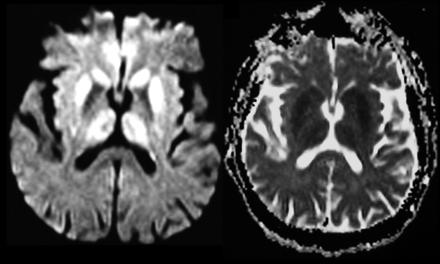 Kallenberg K. et al.