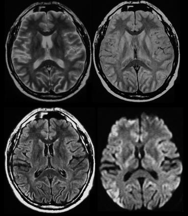 Kallenberg K. et al.