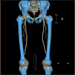 3D CT veľké