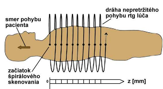 Špirálové CT súčasné skenovanie + pohyb
