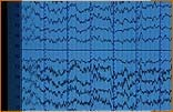 EEG