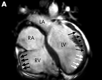 True FISP imaging.